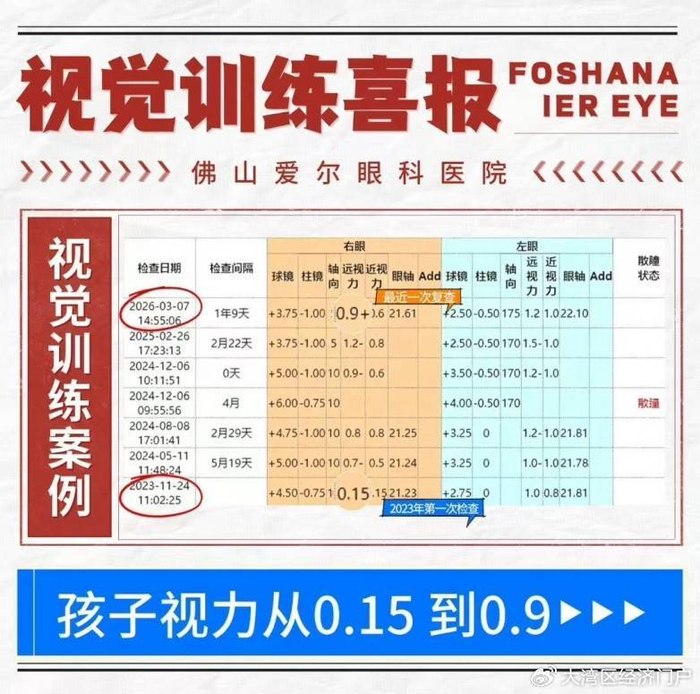佛山爱尔李亮亮博士：用个性化视觉训练，帮孩子“练眼力”